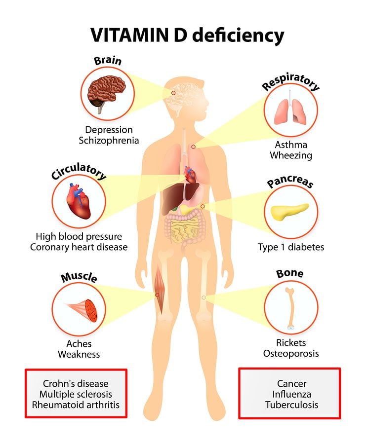 low vitamin D