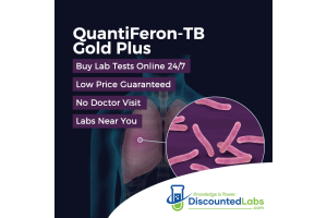 Locate TB Test Near Me: QuantiFERON Gold Blood Test