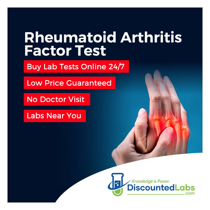 10 Gifts for Rheumatoid Arthritis