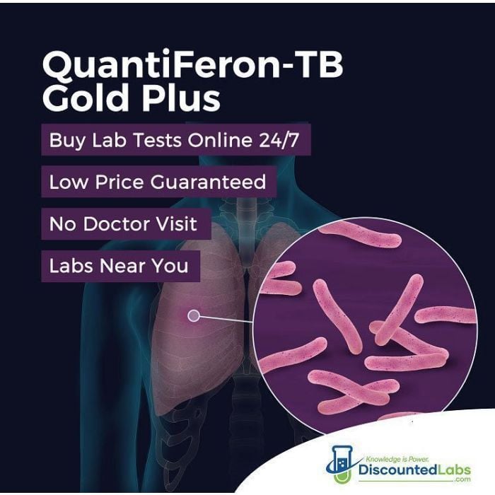 Lowest Cost QuantiFERON Gold Test Discounted Labs