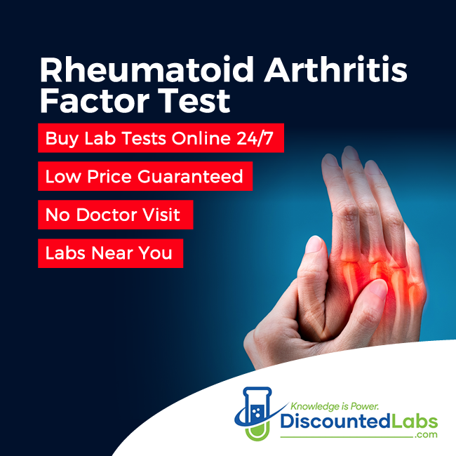 Rheumatoid Arthritis Factor Test   Discountedlabs Arthritis 650x650 